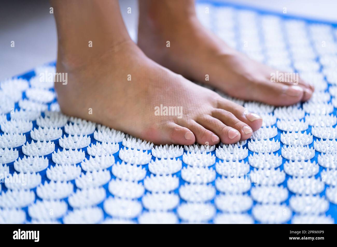 Acupuncture Points Medical Treatment For Woman Stock Photo