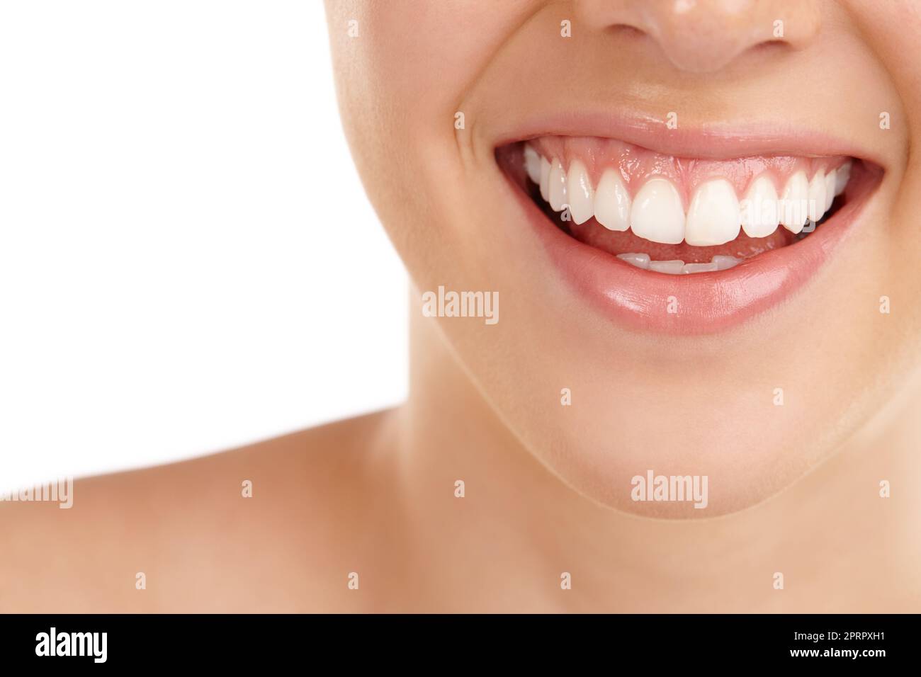 Perfectly white. Closeup shot of a young womans toothy smile against a white background. Stock Photo