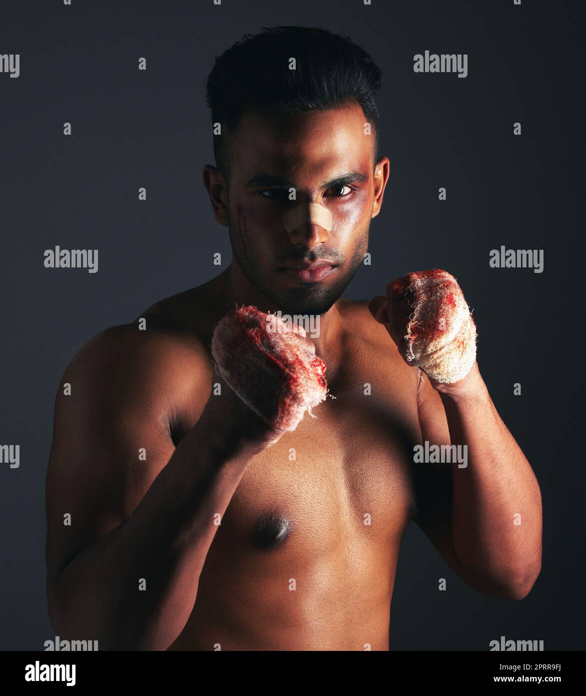 Fight, bruise and bandage with fighter, blood and injury from mma or