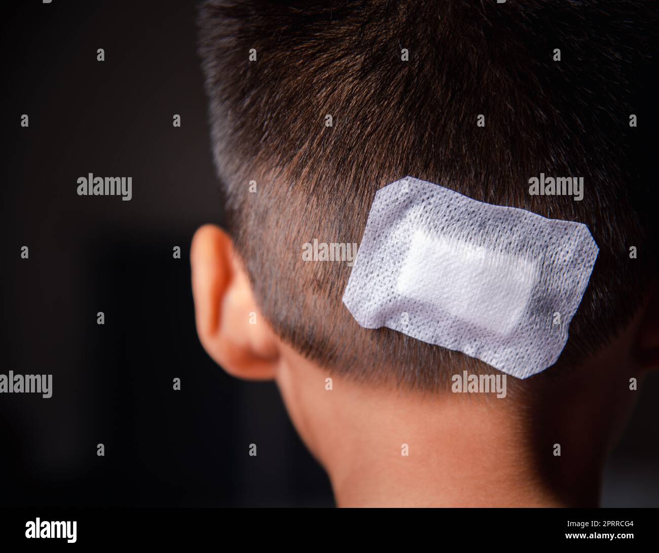 The lacerated suture wound of kid back head which suture with trauma the head by medical bandage, Medical care of the surgery lesion on the head, chil Stock Photo