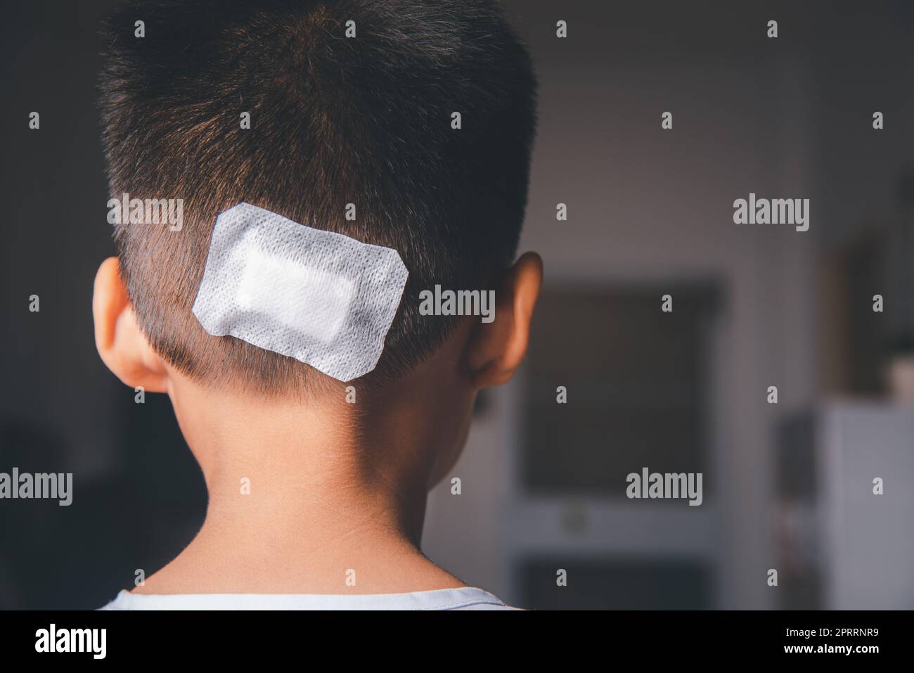 The lacerated suture wound of kid back head which suture with trauma the head by medical bandage Stock Photo