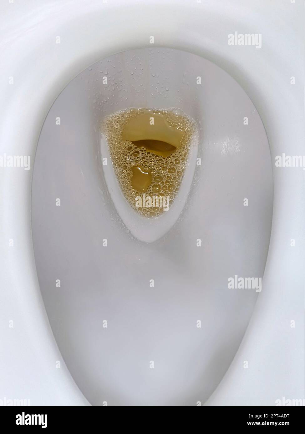 bathroom toilet with dark colored urine Stock Photo - Alamy