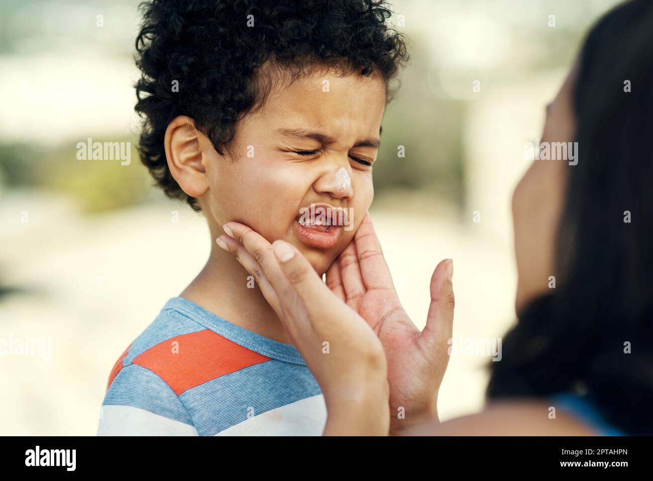 Your delicate skin burns easily. a mother applying sunscreen to her son