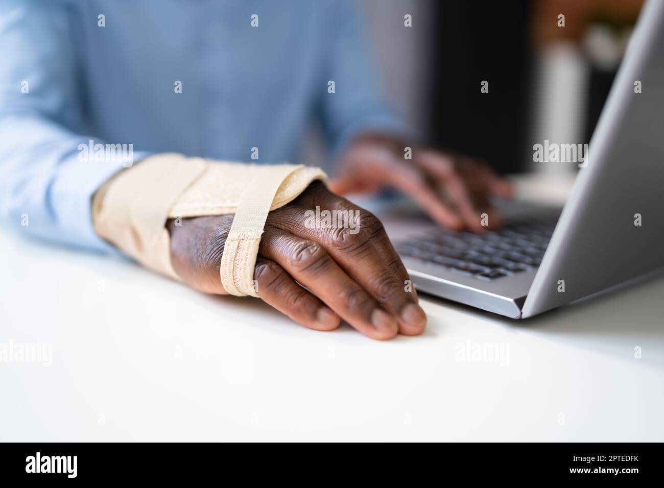 Broken Arm Office Accident. Worker Compensation And Social Coverage Stock Photo