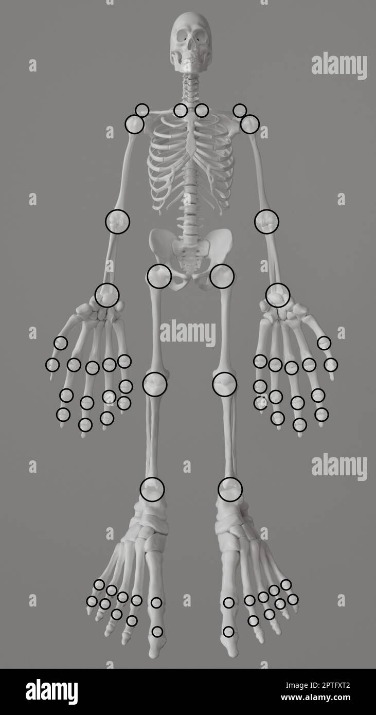 Joint manikin for determining painful swollen joints 3D rendering