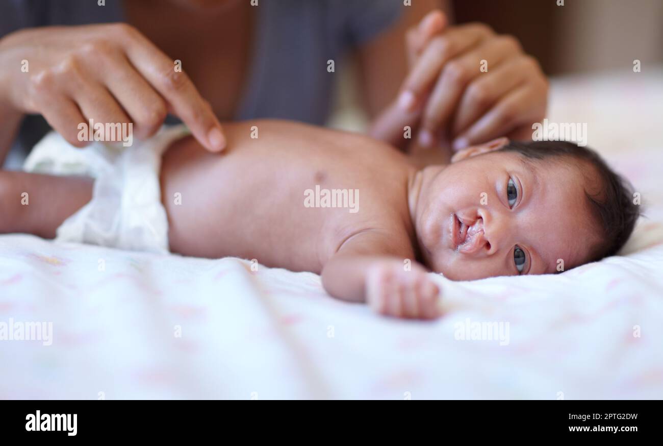 Seeing the world for the first time. a young mother gently touching her young baby who has a cleft palate Stock Photo