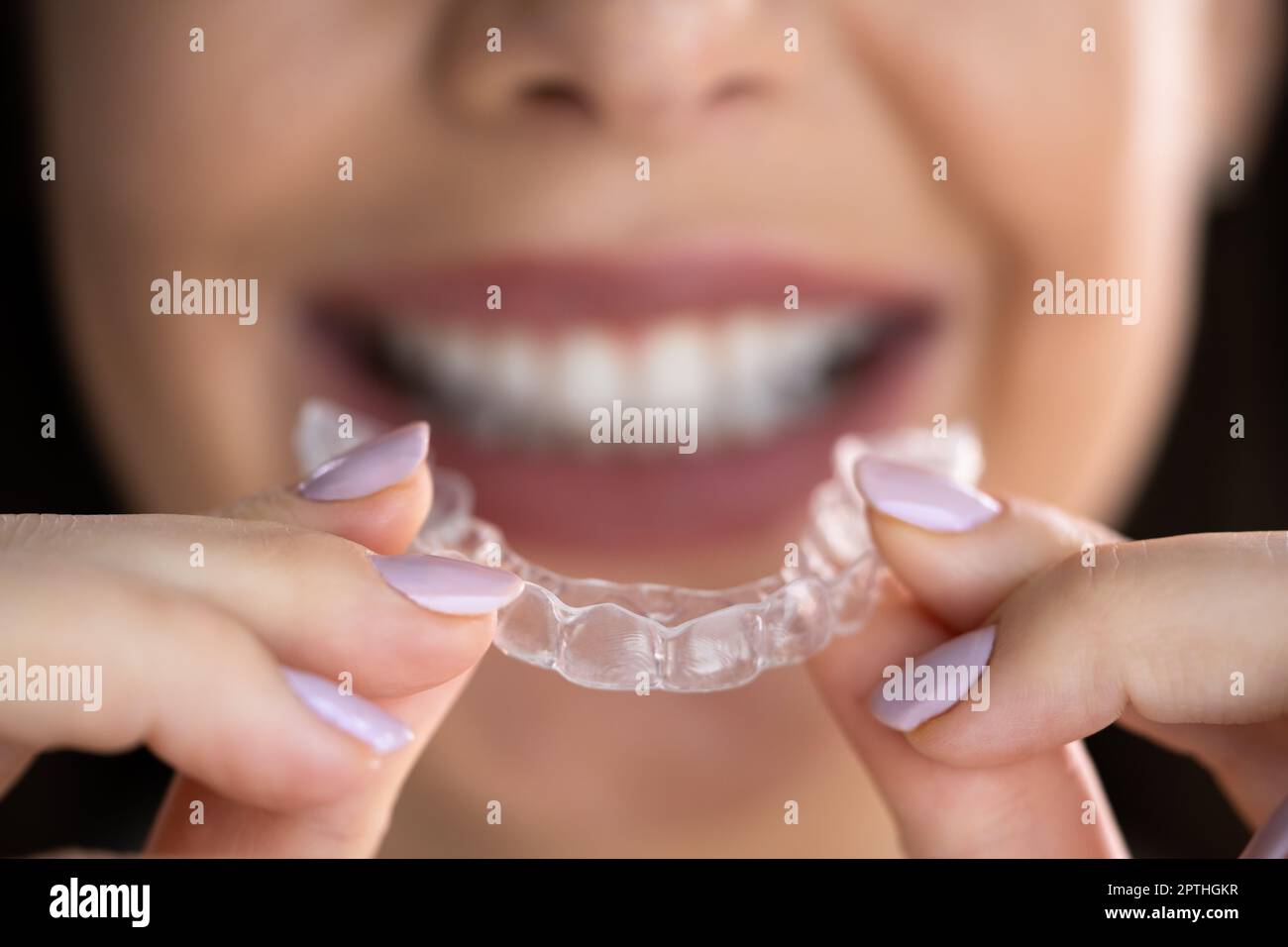 Clear Aligner Dental Night Guard For Teeth Stock Photo Alamy