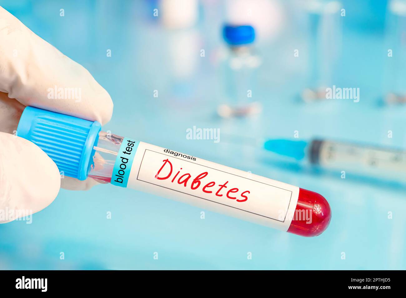 Sample blood for screening diabetic test in blood tube on a blue laboratory background.. To