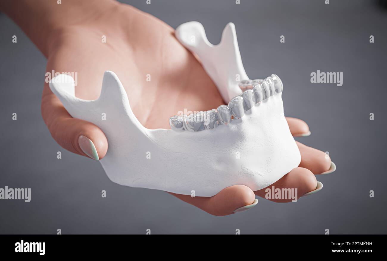 The woman's hand holds a transparent orthodontic aligner device on
