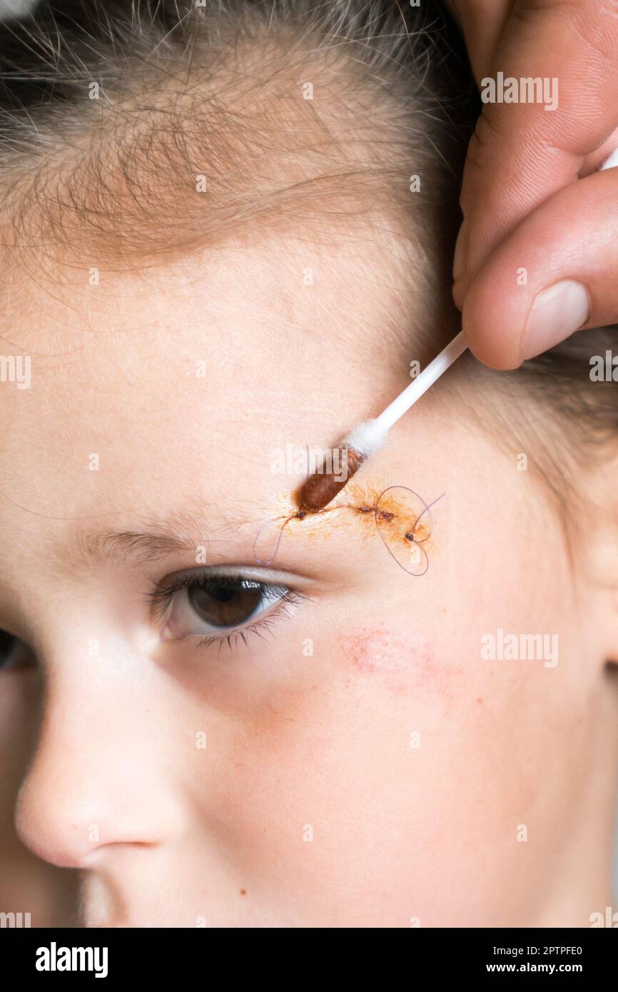 Vertical close up patient, tired child girl face with cropped man hand
