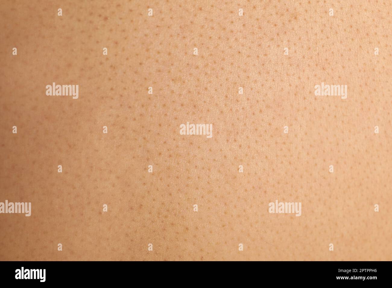 Texture of human skin with birthmarks, closeup view Stock Photo - Alamy