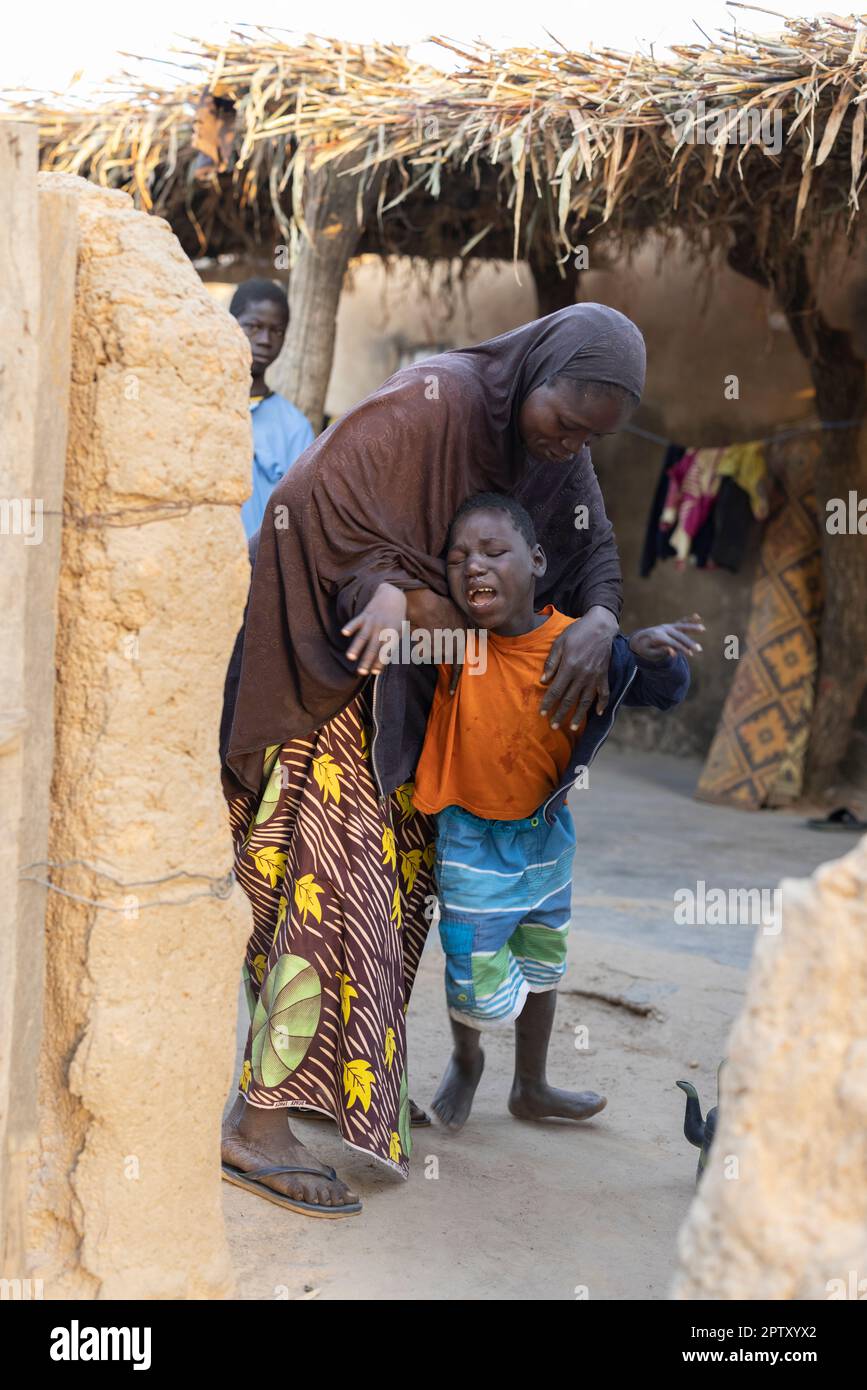 An African mother dresses her son, who has cerebral palsy, at their family home in Segou Region, Mali, West Africa. 2022 Mali drought and hunger crisis. Stock Photo