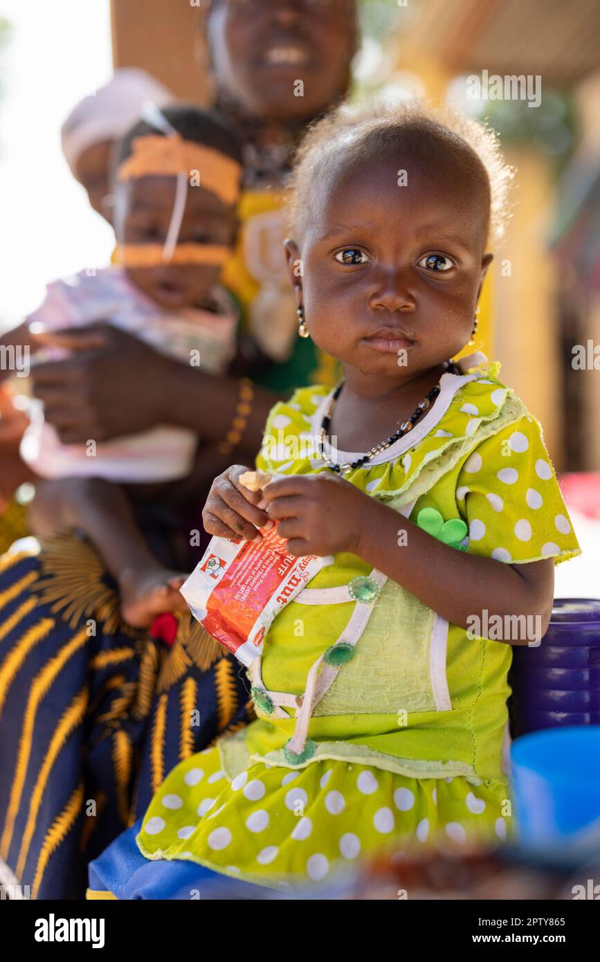 Child eating the theraputic food Plumpy'Nut while in hospital for malnutrition in Segou Region, Mali, West Africa. 2022 Mali drought and hunger crisis. Stock Photo