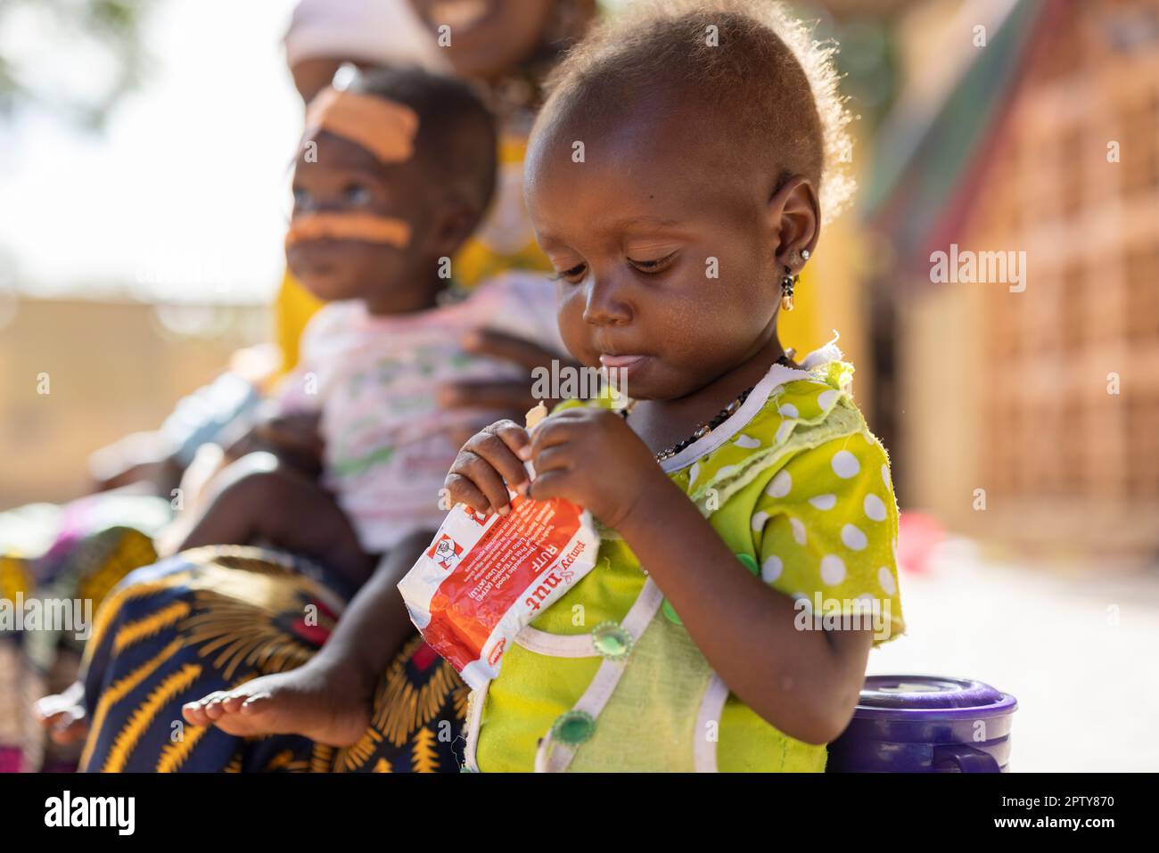 Child eating the theraputic food Plumpy'Nut while in hospital for malnutrition in Segou Region, Mali, West Africa. 2022 Mali drought and hunger crisis. Stock Photo