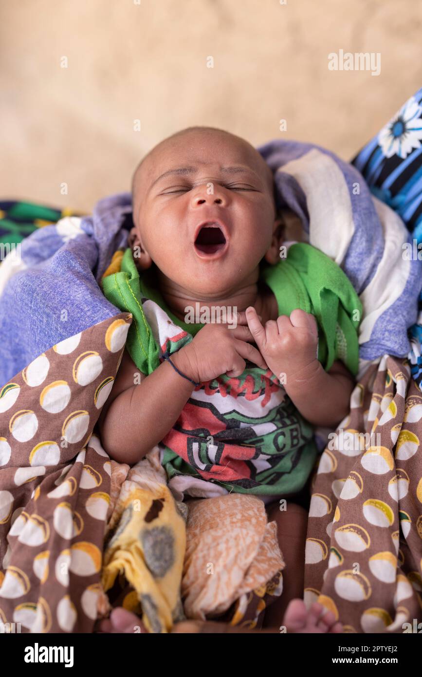 A newborn child, weeks old, yawns in Segou Region, Mali, West Africa. 2022 Mali drought and hunger crisis. Stock Photo
