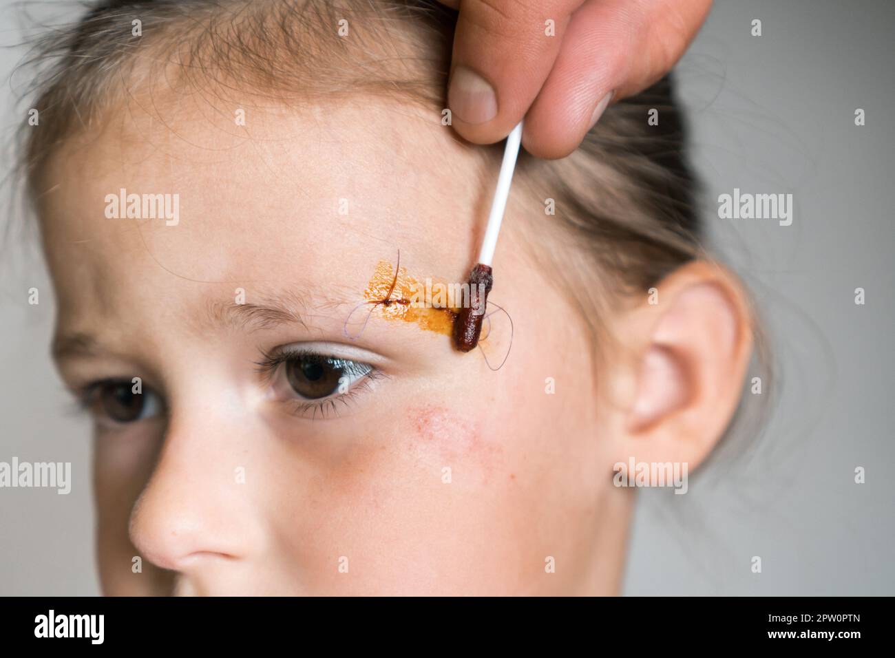 Close up sad, patient kid girl face with cropped man hand healing
