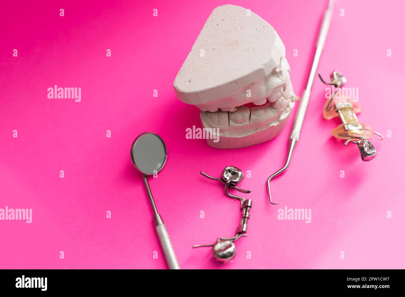 Dental models top view. Jaw models with different problems. Treatment