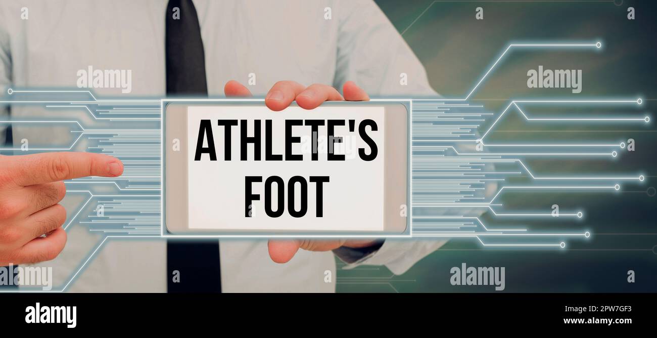 Conceptual display Athlete's Foot, Business overview a fungus infection of the foot marked by blisters Stock Photo