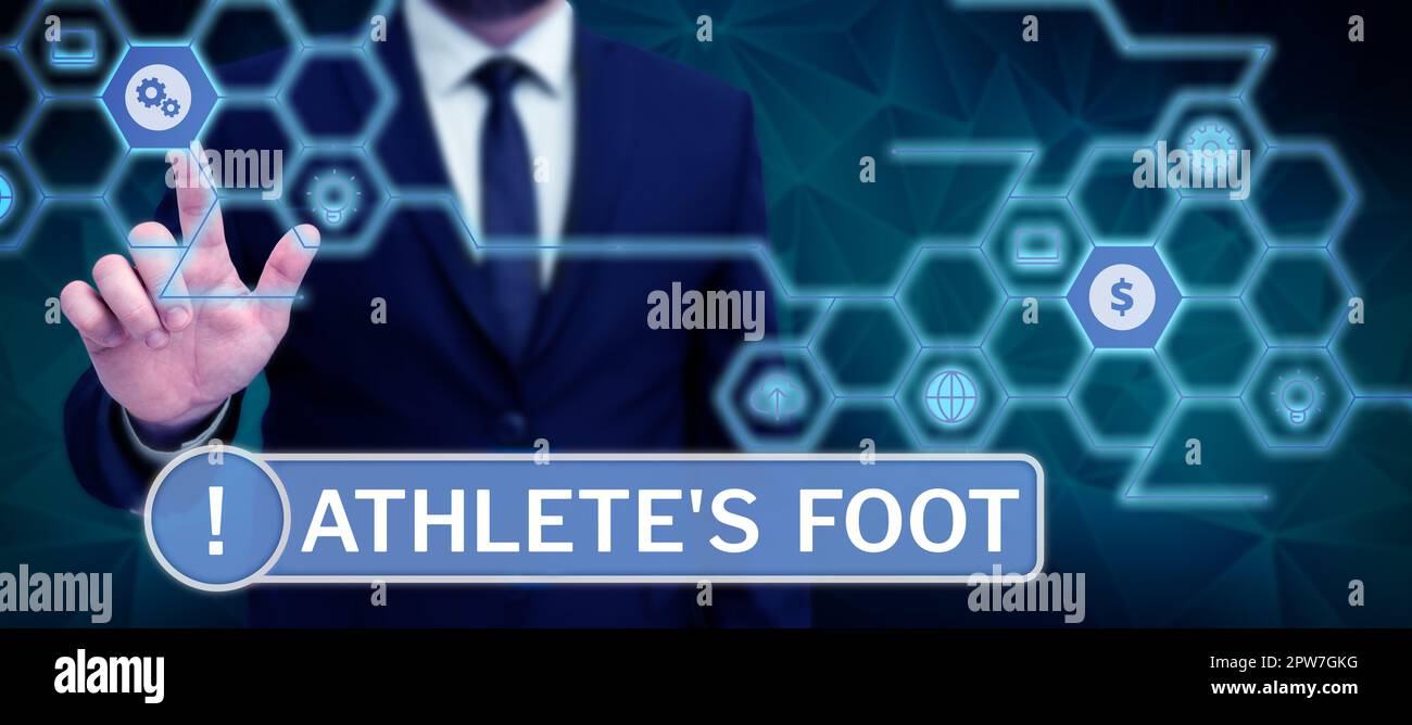 Sign displaying Athlete's Foot, Business idea a fungus infection of the foot marked by blisters Stock Photo