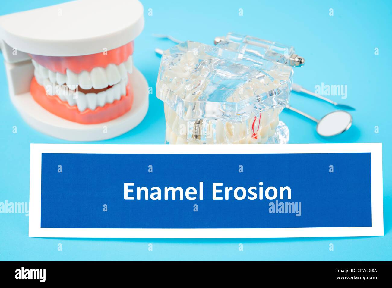 Teeth model and Enamel Erosion dental disease with tools dental on blue