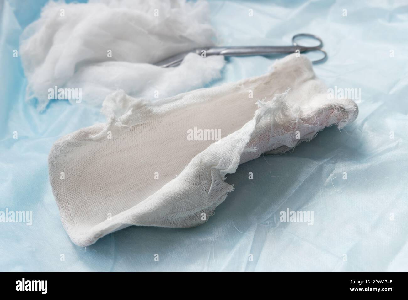 Cast removed from a broken arm after recovery Stock Photo Alamy