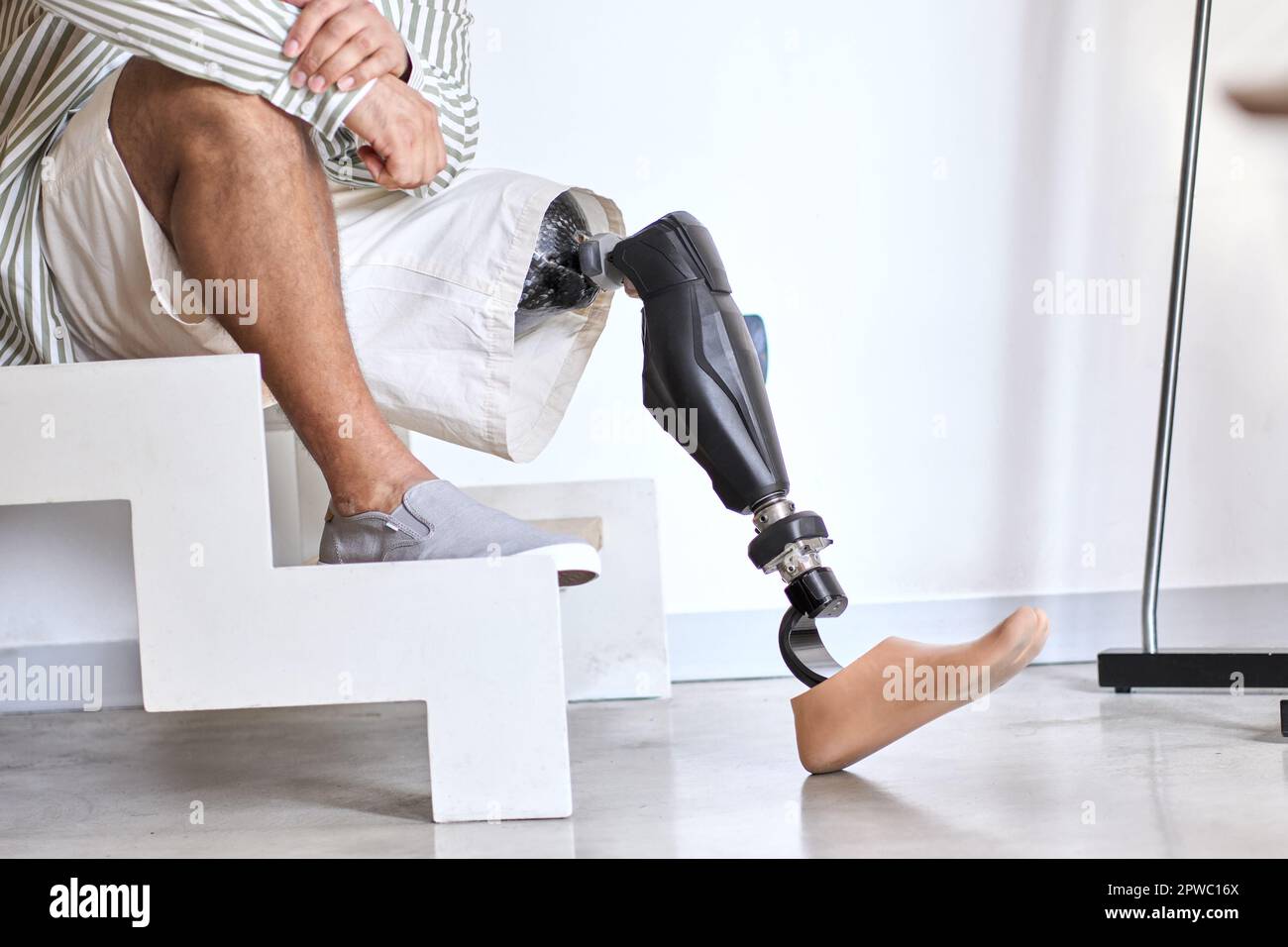Above knee amputation hires stock photography and images Alamy