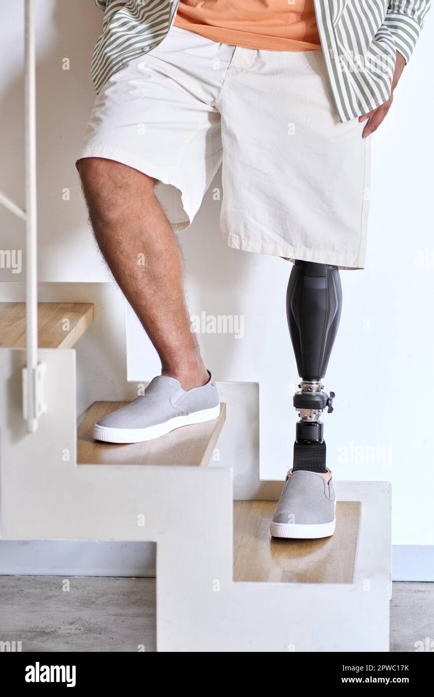 Above Knee Amputee Medical Hi-res Stock Photography And Images - Alamy