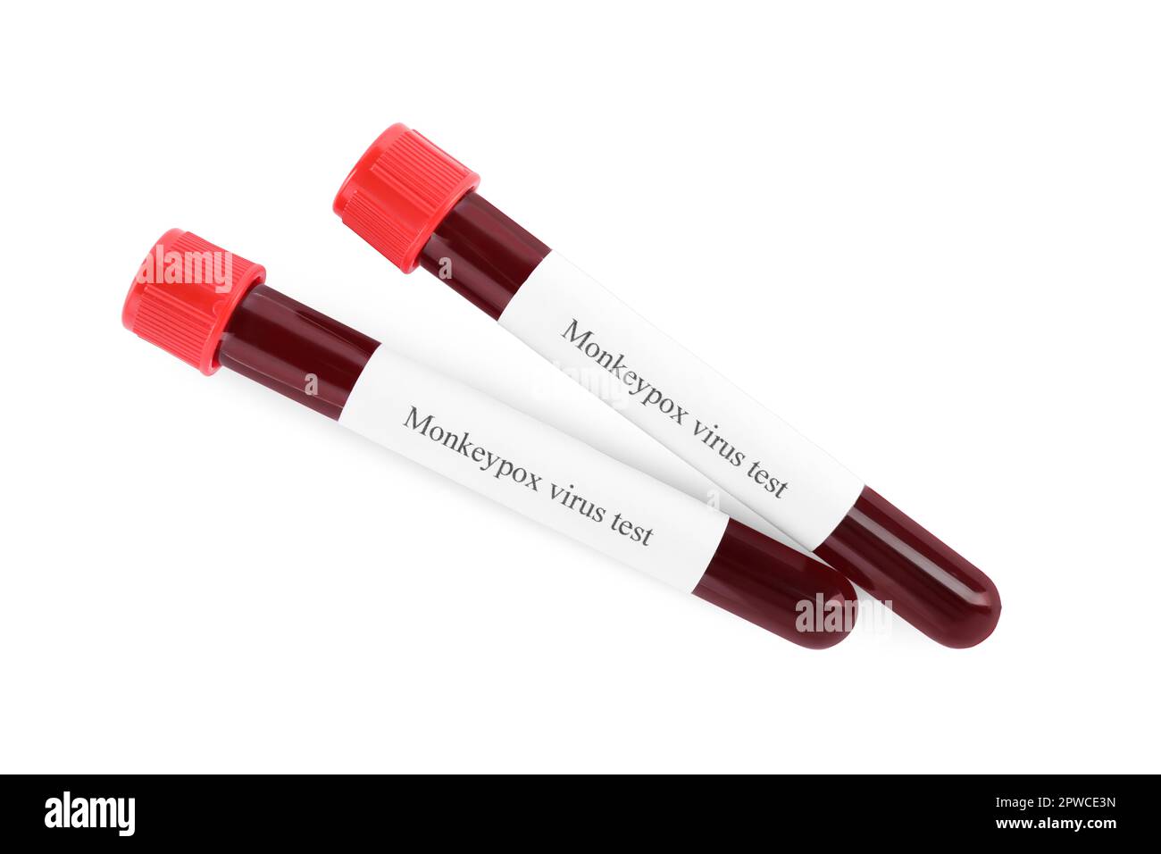Monkeypox virus test. Sample tubes with blood on white background Stock ...