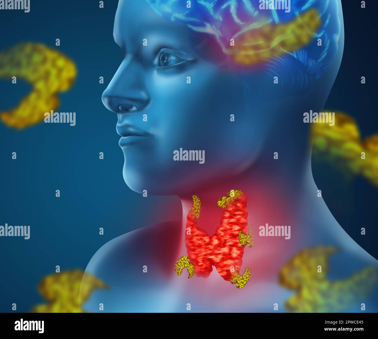 Illustration of human with inflamed thyroid gland on color background