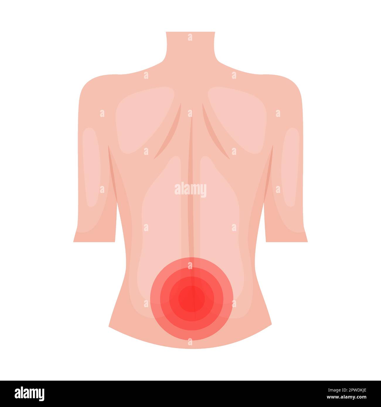 throbbing pain in lower back. Traumas of skin on body part. Vector illustration of open cut wounds with bleeding, fracture and bruise. Cartoon Stock Vector