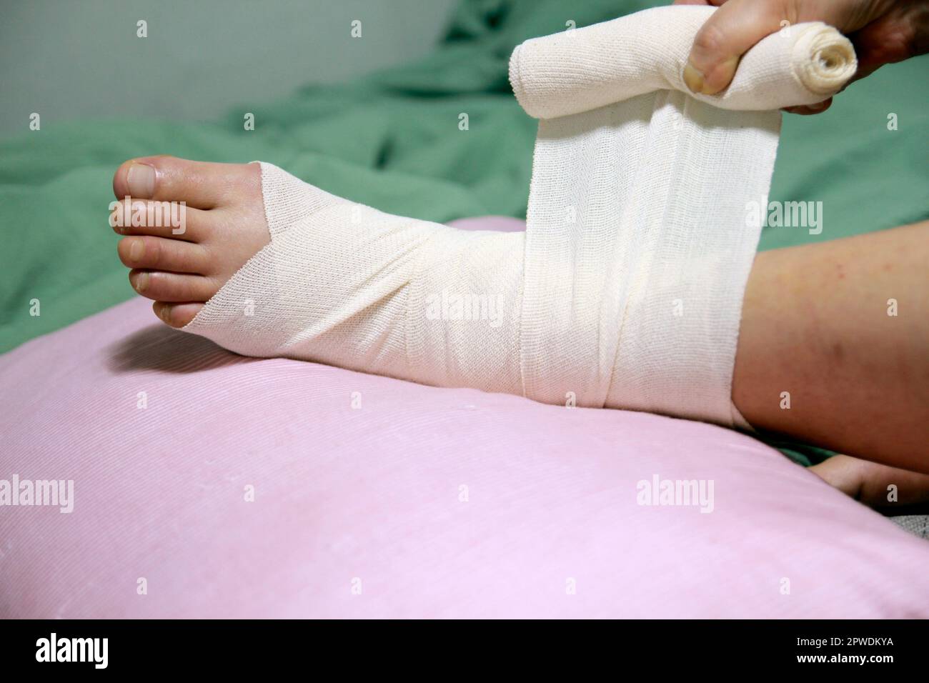 Concept of bandaging and treating an ankle injury at home Stock Photo