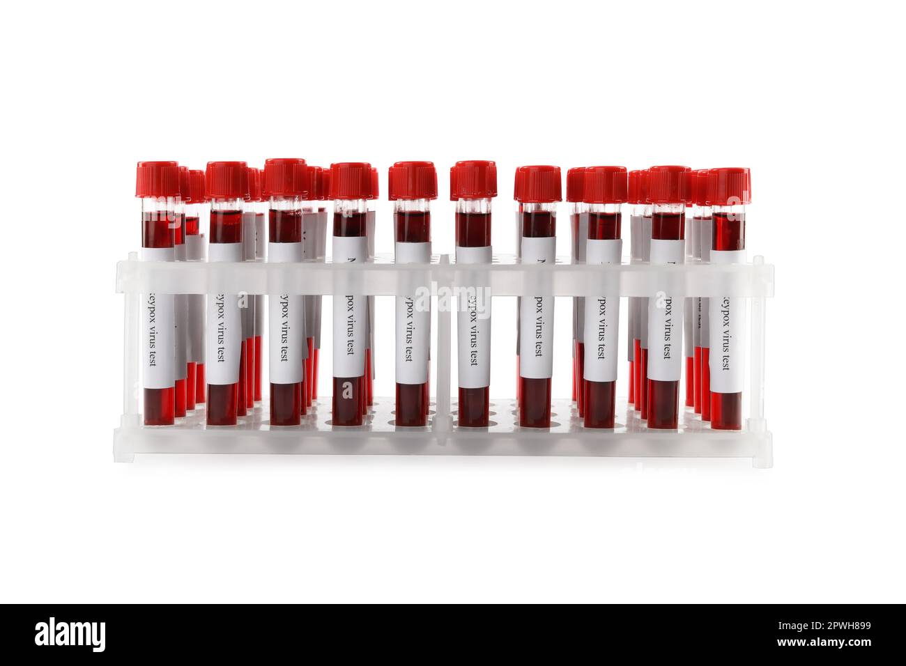 Monkeypox virus test. Many sample tubes with blood in rack on white ...