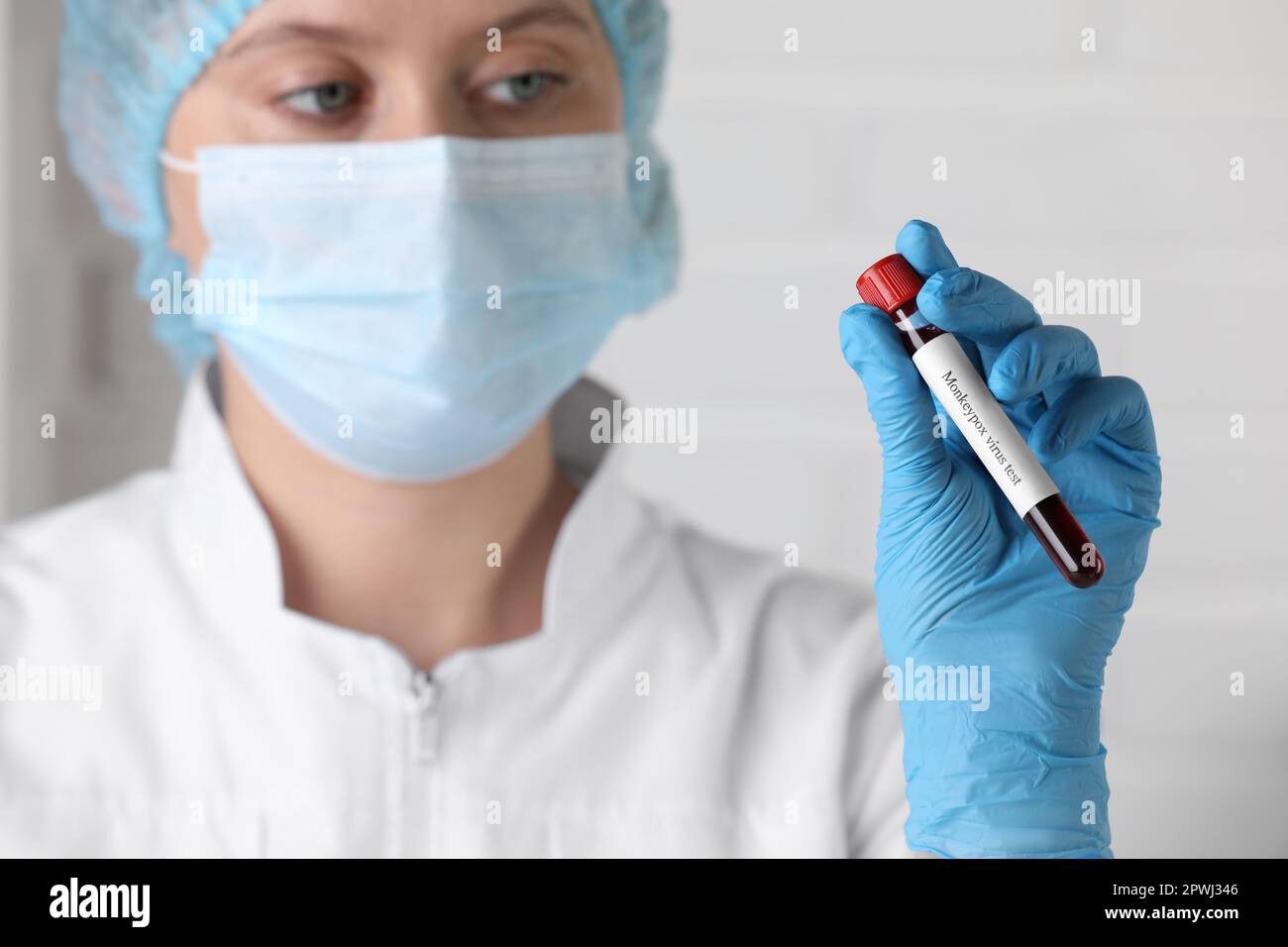 Monkeypox virus test. Laboratory worker holding sample tube with blood ...