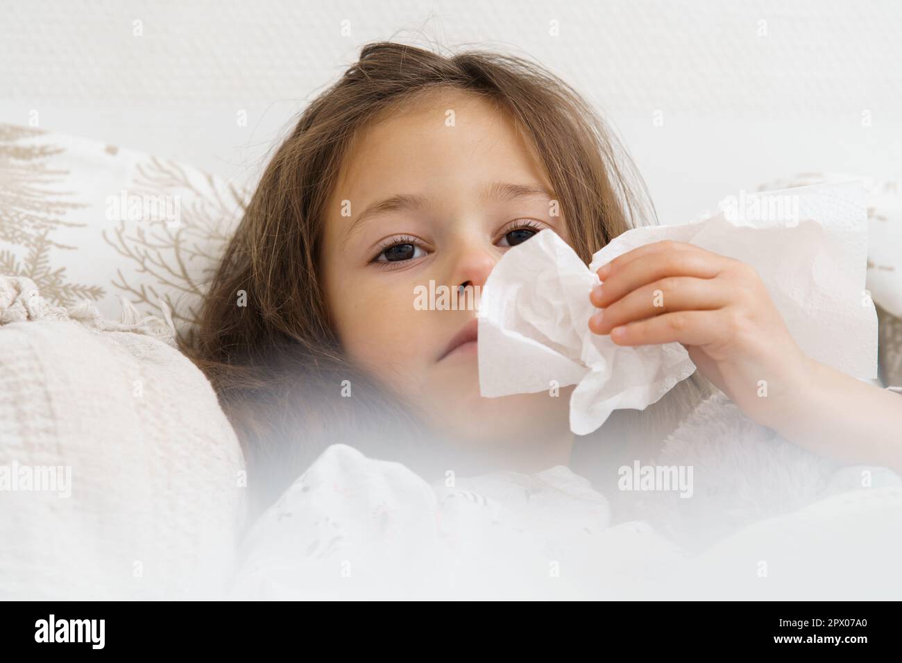 Little girl blow stuffy nose with white handkerchief. Portrait closeup of unhealthy child