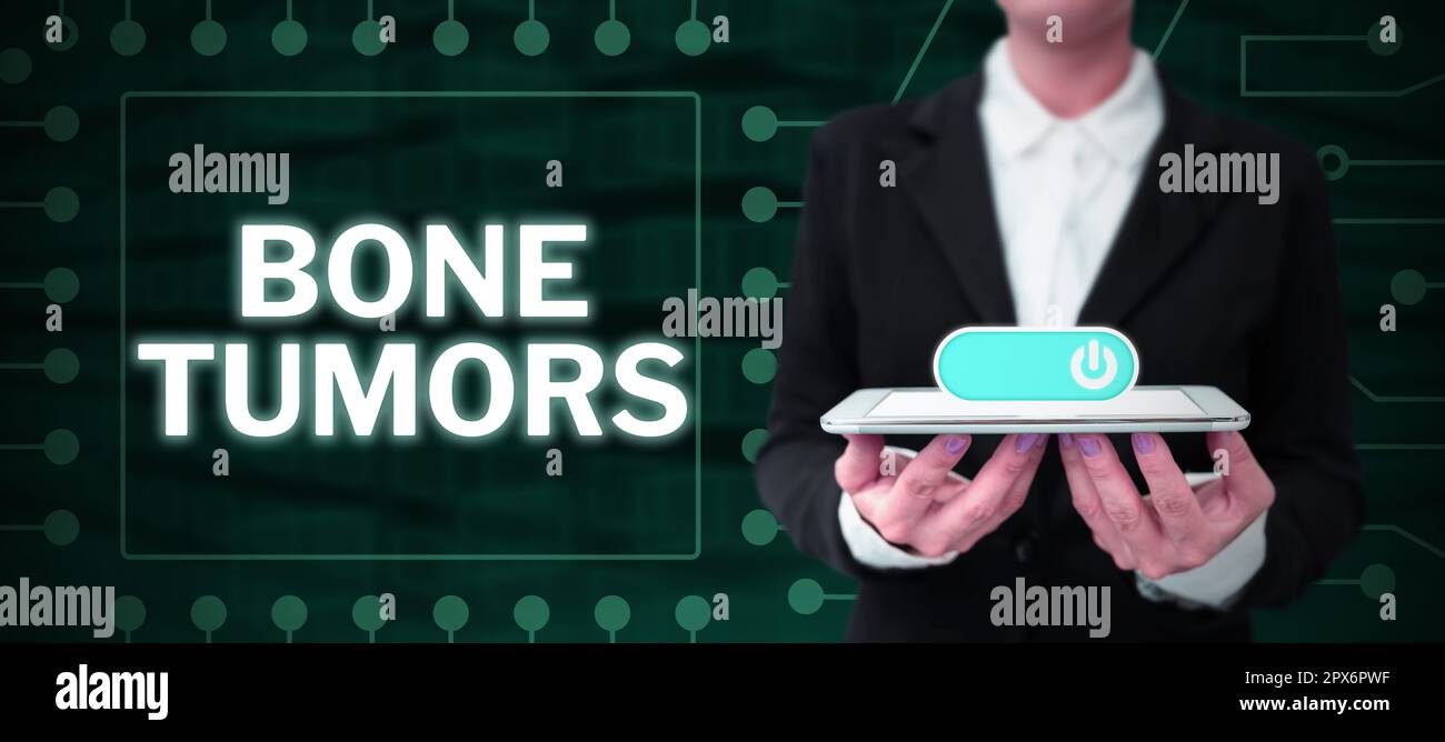 Sign displaying Bone Tumors, Business showcase can be either benign or ...