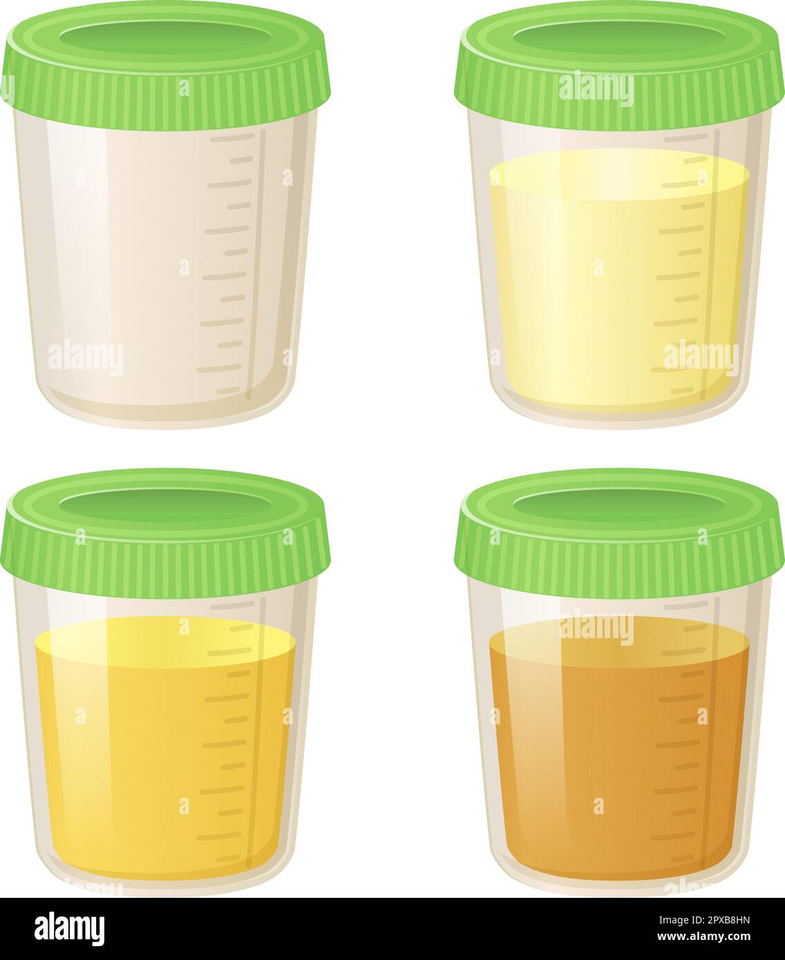 Pee in a plastic container set. Collection of Urine Analysis Vials in