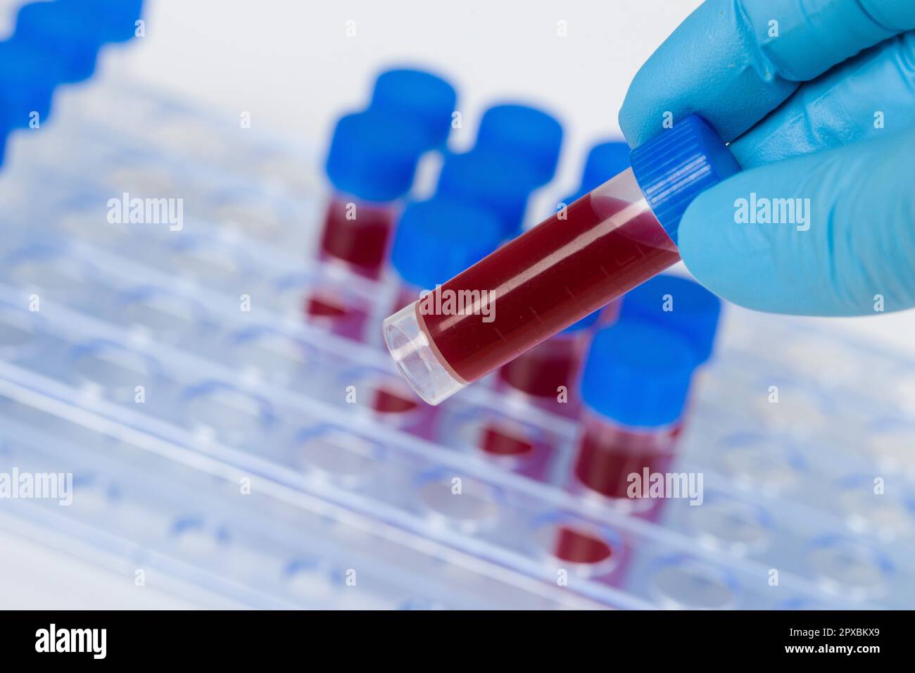 close up of handling test tubes with blood in a rack Stock Photo - Alamy