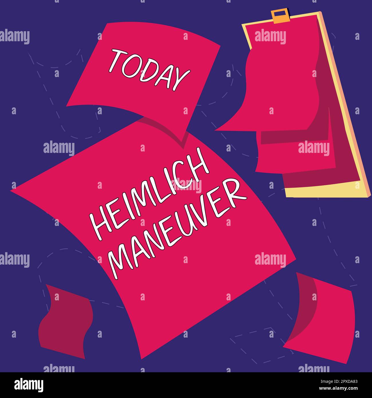 Conceptual Caption Heimlich Maneuver Concept Meaning Application Of Upward Pressure In Case Of 