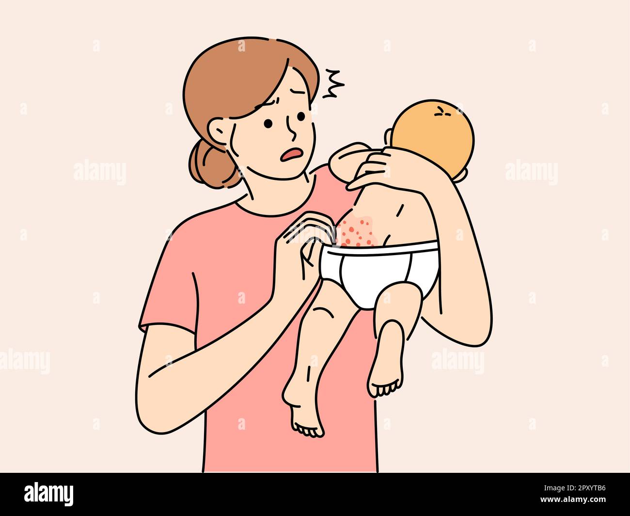 Anxious young mother confused with newborn baby body rash. Worried mom