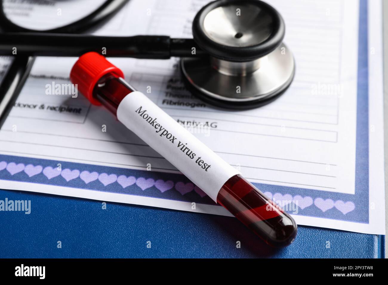 Sample tube with label Monkeypox Virus Test and blood on medical form ...