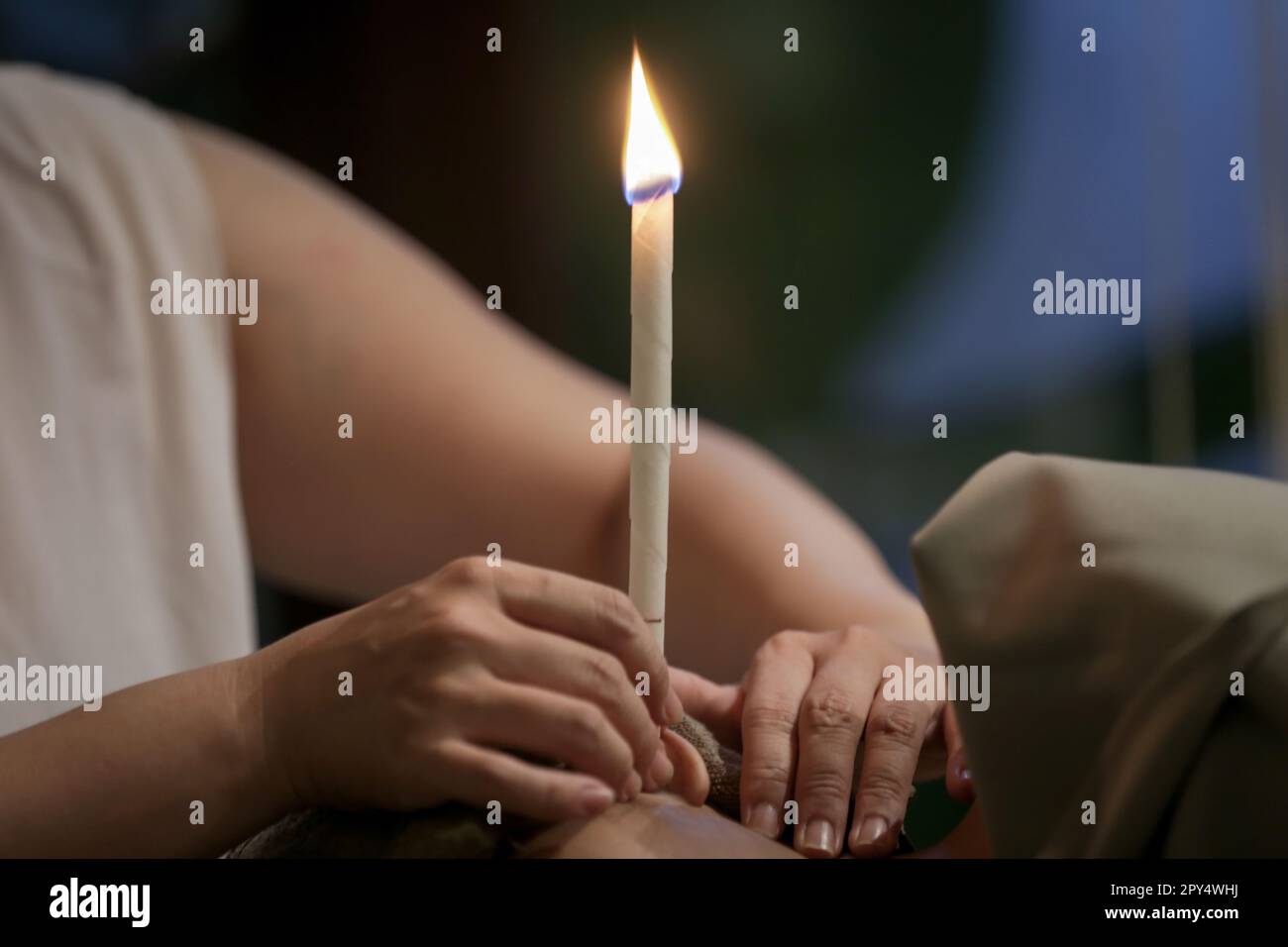 Woman receiving ear candle treatment at spa. Ear coning or thermal
