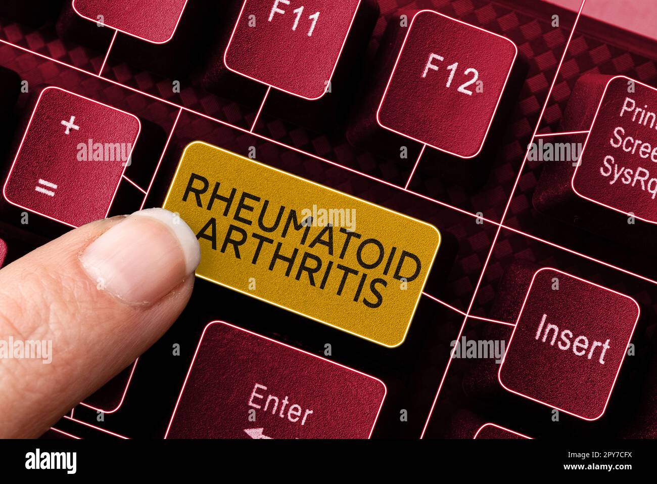 Conceptual display Rheumatoid Arthritis. Word for autoimmune disease that can cause joint pain and damage Stock Photo