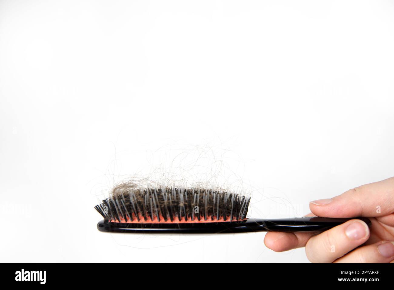 Hair loss problem, postpartum period, menstrual or endocrine disorder