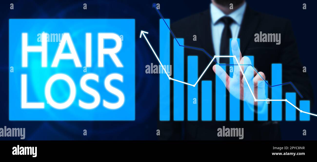 Hand writing sign Hair Loss. Business overview Loss of human hair from