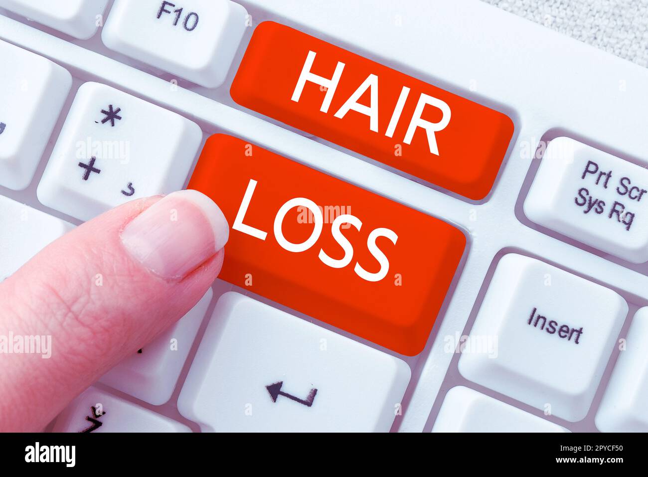 Text caption presenting Hair Loss. Business concept Loss of human hair from the head or any part of the body Balding Stock Photo