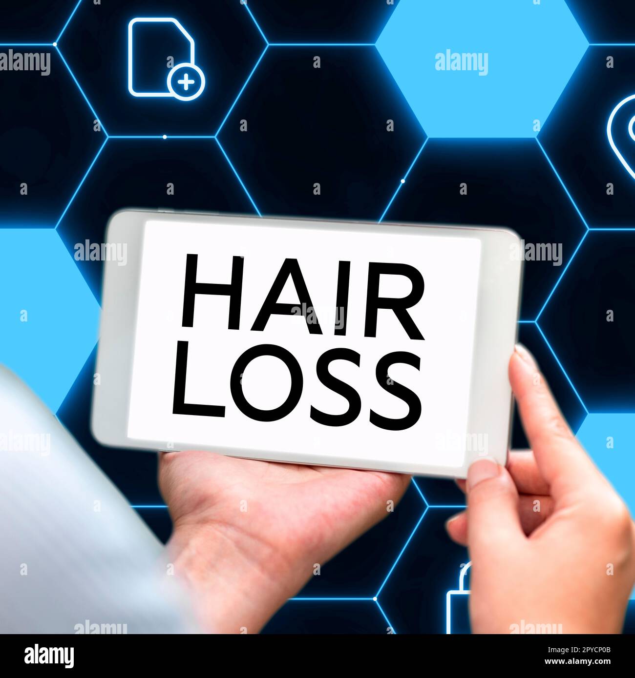 Text showing inspiration Hair Loss. Internet Concept Loss of human hair from the head or any part of the body Balding Stock Photo