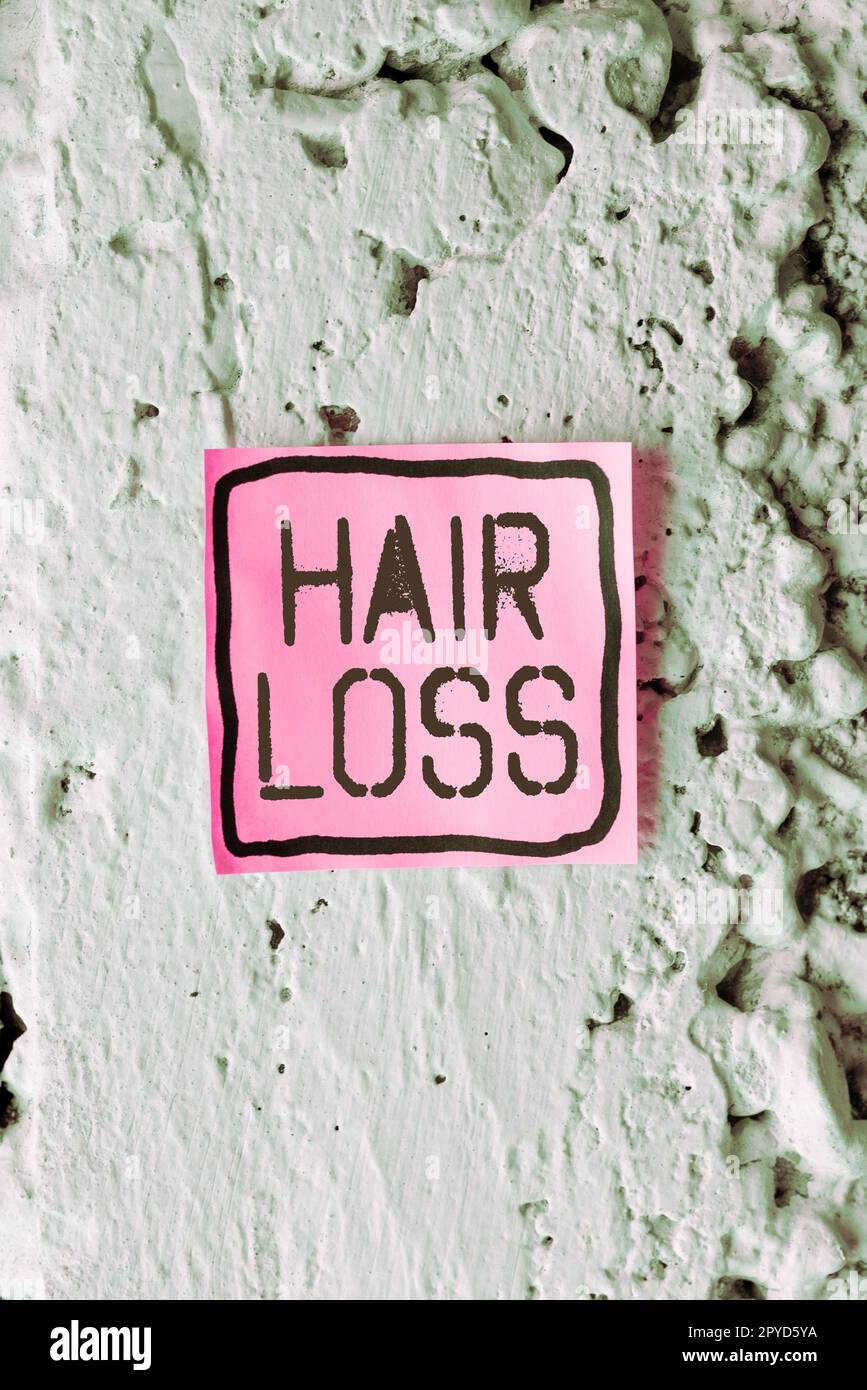 Handwriting text Hair Loss. Word for Loss of human hair from the head or any part of the body Balding Stock Photo