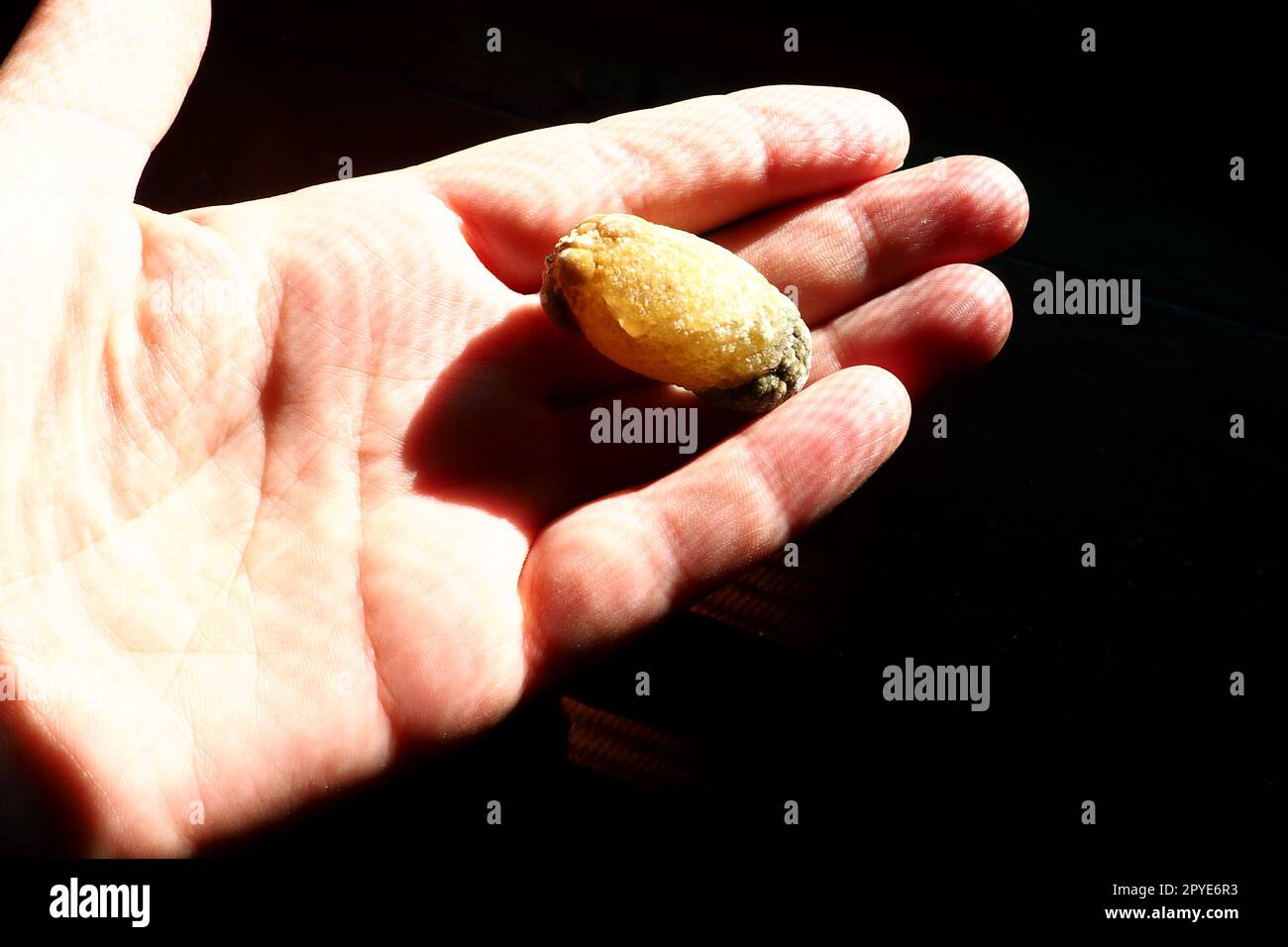 Gallstone disease, cholelithiasis - the formation of stones, stones in the gallbladder, bile ducts. Gallstones. A large gallstone removed from a patient's body, 2.5 cm long. Stock Photo