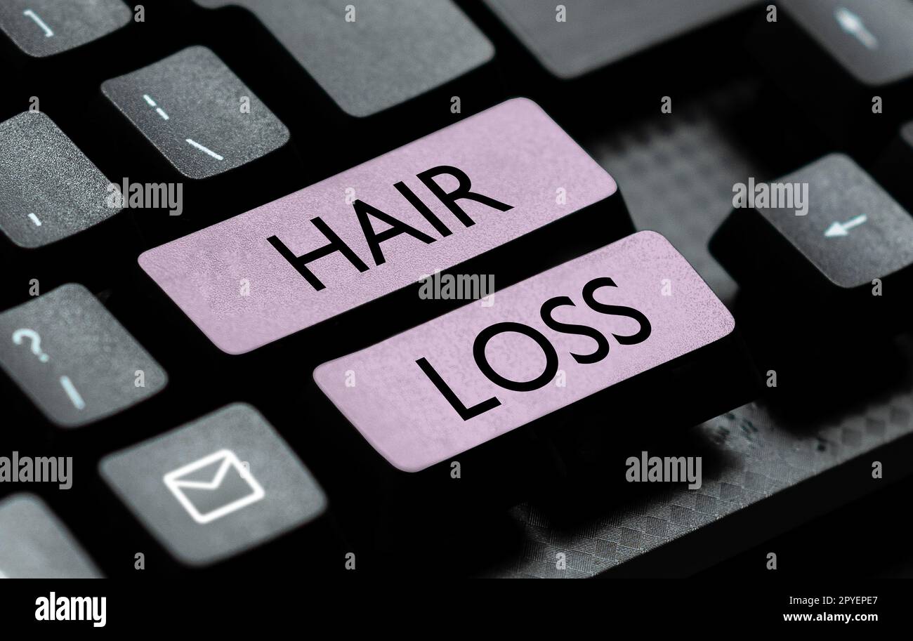 Hand writing sign Hair Loss. Concept meaning Loss of human hair from the head or any part of the body Balding Stock Photo