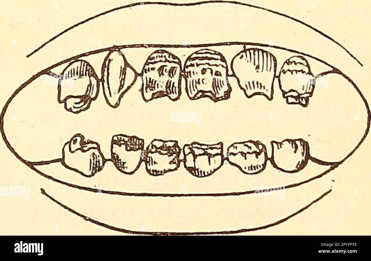 "Principles and practice of operative dentistry" (1901 Stock Photo Alamy